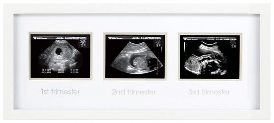 Sonogram Pregnancy Keepsake Frame